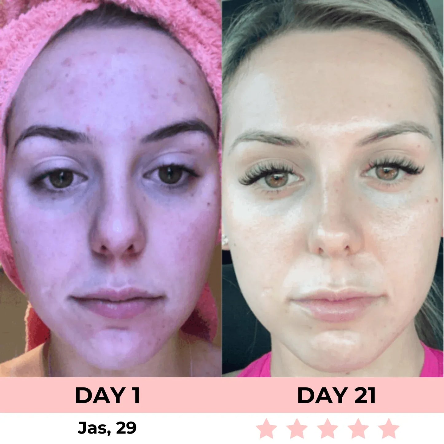 skinrenowa device